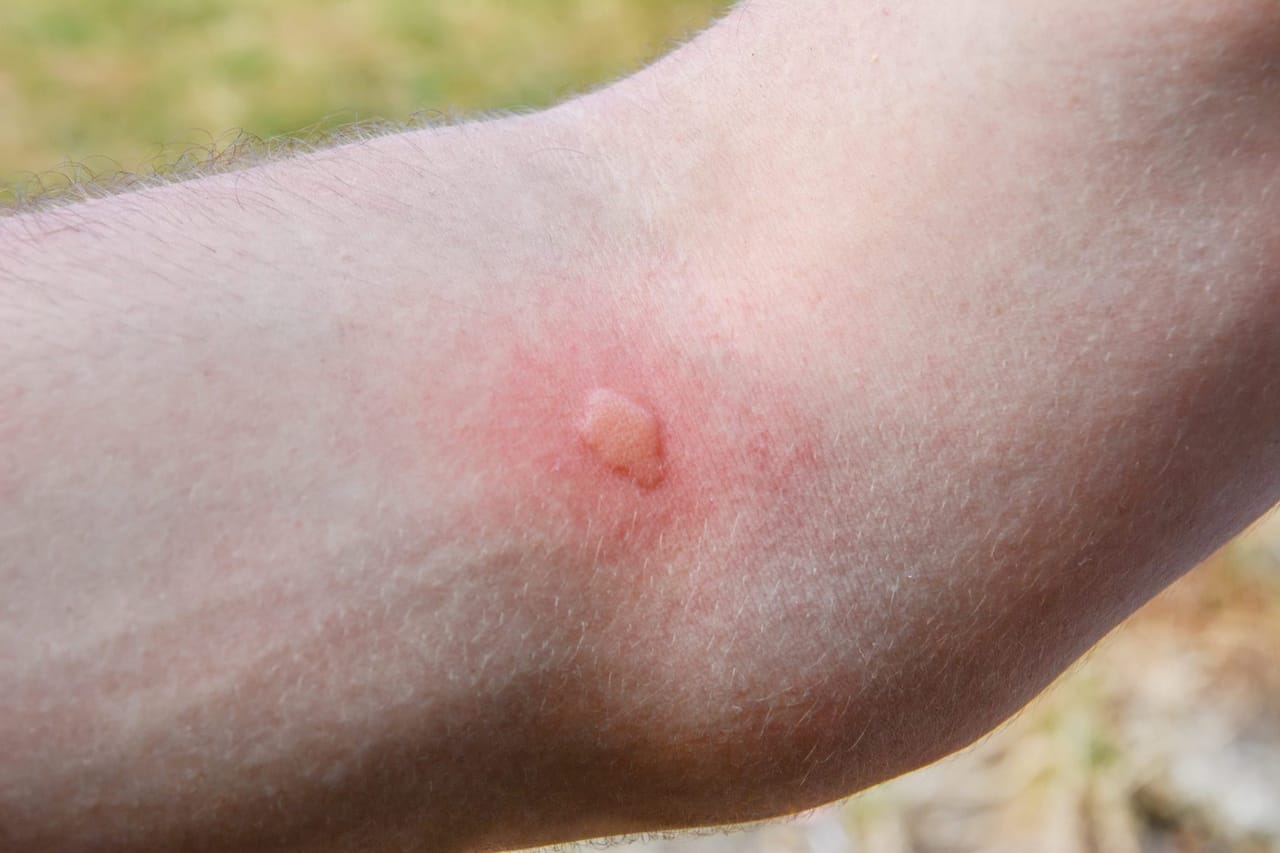 Signs of mosquito activity